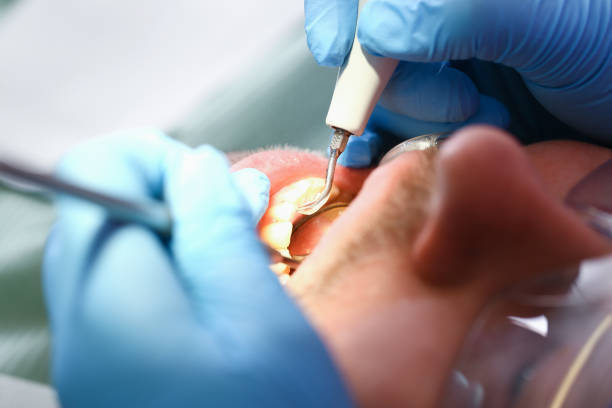 Best Walk-In Emergency Dentist in Greeneville, TN