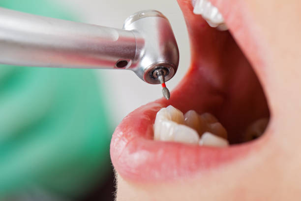 Best Pediatric Emergency Dentist in Greeneville, TN
